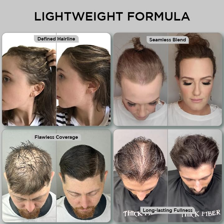 Hair Fibres Dark Brown, Hair Fibers For Men Professional Quality Fibre Hair Powder Spray Hair Building Fibers Hair Loss Concealer for Men and Women for Bald Spots & Thinning Hair (Dark Brown) - Naturhealth UK #