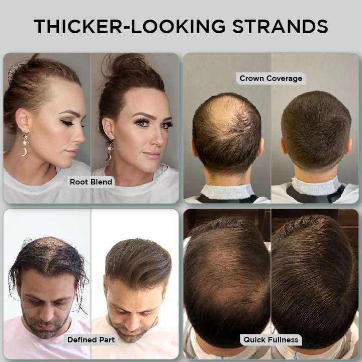 Hair Fibres Dark Brown, Hair Fibers For Men Professional Quality Fibre Hair Powder Spray Hair Building Fibers Hair Loss Concealer for Men and Women for Bald Spots & Thinning Hair (Dark Brown) - Naturhealth UK #